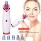 Electric USB Rechargeable Blackhead and Pore Remover