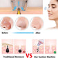 Electric USB Rechargeable Blackhead and Pore Remover